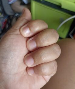 Dr. Scholl's Dual Action Freeze Away WART Remover, 8 Applications // Freeze Therapy + Powerful Fast Acting Salicylic Liquid to Remove Common and Plantar Warts, 0.33 Fl Oz, 1 Count 44 6118FcXm RL