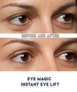 Eye Magic Original Eye Lift Kit (Small/Medium Size With Gel) Lifts Eyelid Droop and Hooded Eyes | Open And Show Off Your Beautiful Eyes | Made In America 15 6118nvWaebL
