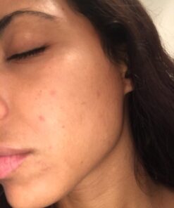 Kleem Organics Pure Vitamin C Serum for Face with Hyaluronic Acid & Vitamin E - Anti Aging Vitamin C Face Serum for Women to Boost Collagen, Reduce Wrinkle, Acne, Dark Spot & Sun Damage - Vit C Serum 1 Fl Oz (Pack of 1) 34 611HimXmqTL