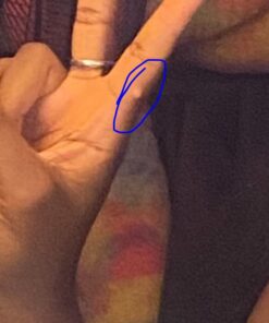 Dr. Scholl's Dual Action Freeze Away WART Remover, 8 Applications // Freeze Therapy + Powerful Fast Acting Salicylic Liquid to Remove Common and Plantar Warts, 0.33 Fl Oz, 1 Count 39 611tea3E2HL