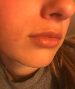 NZ Country Manuka Oil | 100% Pure Organic Essential Oil | Natural and Effective Skin Care | Plant Therapy Essential Oils for Body, Nails, Hair, Skin & Lips | 35x Stronger Than Organic Tea Tree Oil 32 6126glI72LL