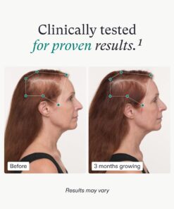 Nutrafol Women's Balance Hair Growth Supplements, Ages 45 and Up, Clinically Proven Hair Supplement for Visibly Thicker Hair and Scalp Coverage, Dermatologist Recommended - 3 Month Supply, Pack of 3 17 612JyrMW0aL