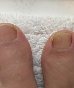 3 in 1 Professional Foot Spa Kit-with Tea Tree Foot & Body Soak-Tea Tree Body Wash & Nail Blend-Soothes Dry, Burning & Itchy Skin-Refreshes Unwanted Foot Odor-Restores Unhealthy Nails-Purely Northwest Tea Tree Oil 3 Piece Set 49 612Xw6MQPAL 1