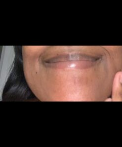 Active Skin Repair First Aid Scar Shield Hydrogel - Scar Treatment for Cuts, Scrapes, Burns and Other Wounds to Stop Scars BEFORE They Form - Natural and Non-Toxic Scar Prevention Gel (3 oz Gel) 26 612pNEA2AiL