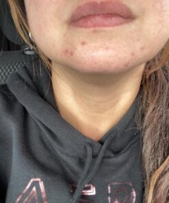 Sports Research Evening Primrose Supplement from Cold Pressed Oil - Softgels for Women’s Health & Skin Health - Gluten Free & Non-GMO GLA - High Potency 1300mg, 120 Count 120 Count (Pack of 1) 37 613ACbyZ6rL