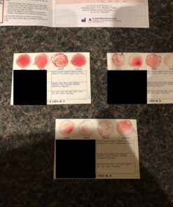 Eldoncard Blood Typing Kit, 3 Tests, Know Your Blood Type, Instant Home Testing Kit, A, O, B, Rhs-D Negative and Positive Blood Types Tested For 28 613xoIDcTOL