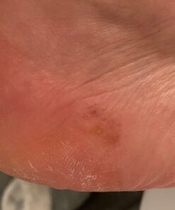 Re+Gen Nutrition Immune Support Supplement for Adults, Natural Capsules with Zinc, Vitamin C, L lysine Amino Acid & Oregano Oil for Strong Immunity Health in Men & Women, 120 Capsules 18 613xs 5M2RL