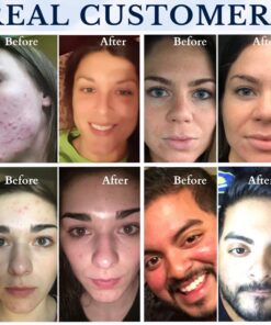 Face Wash, Facial Cleanser, Oil Cleanser - Helps as a Blackhead Remover with Organic Rosemary Oil, Shea Butter and Aloe Vera - Gentle Facewash To Soften, Soothe & Balance Skin, Made in USA, 4oz 26 614El82C4nL