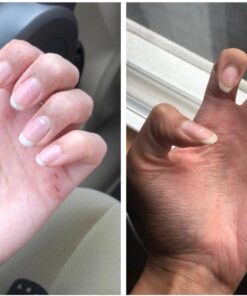 Cortizone 10 Maximum Strength Plus Ultra Moisturizing Anti-Itch Cream, 1% Hydrocortisone, 2 oz. Old Packaging 20 614HDBcXHpL