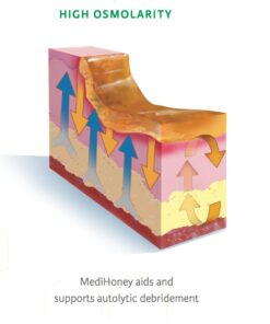 Improved Medihoney Gel Wound and & Burn Dressing from Derma Sciences, 0.5 oz, 24 614jWziHD4L 3
