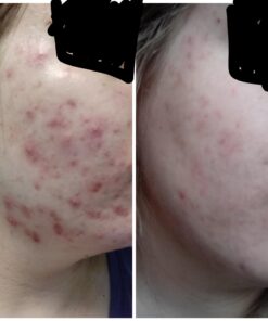 NOW Foods Supplements,Pantothenic Acid (Vitamin B-5) 500 mg,B-Complex Vitamin,250 Capsules 250 Count (Pack of 1) 29 614ytWid8kL