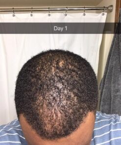 artnaturals Argan Hair Growth Shampoo - (16 Fl Oz / 473ml) - Sulfate Free - Treatment for Hair Loss, Thinning & Regrowth - Men & Women - Infused with Biotin, Argan Oil, Keratin, Caffeine 32 615PcfnUpbL