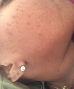 Nubian Heritage African Black Soap, 5 Ounce (Pack of 4) Tea Tree Oil Oats & Aloe 5 Ounce (Pack of 4) 19 615eZlVcrxL