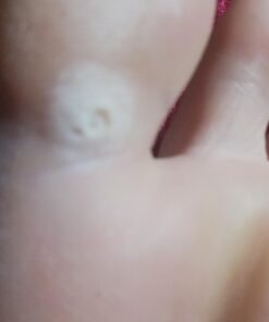 Compound W Maximum Strength One Step Plantar Wart Remover Foot Pads, 20 Count 20 Count (Pack of 1) 50 616FKxZHGJL