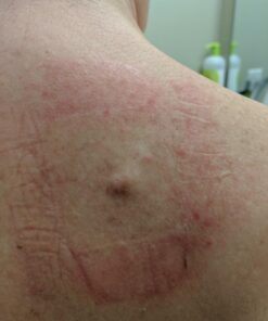 Smile's PRID Drawing Salve by Hyland's, Relief of Topical Pain and Skin Irritations, 18 grams 32 616IO8HzAwL