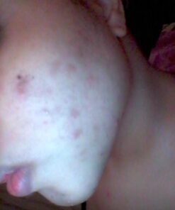 Mario Badescu Glycolic Foaming Cleanser for All Skin Types Glycolic Foaming Cleanser 6 Fl Oz 34 616iy5vxz5L