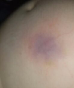 Ben Nye Master Bruise Wheel EW-4 (1 oz/28 gm) 24 616tscq3QfL