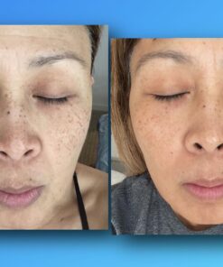 TruSkin Vitamin C Face Serum – Anti Aging Face & Eye Serum with Vitamin C, Hyaluronic Acid, Vitamin E – Brightening Serum, Dark Spot Remover, Even Skin Tone, Eye Area, Fine Lines & Wrinkles, 1 Fl Oz 1 Fl Oz (Pack of 1) 36 616wWsv5EYL