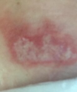 Terrasil Wound Care - 3X Faster Healing, Infection Protection Ointment for bed sores, pressure sores, diabetic wounds, ulcers, cuts, scrapes, and burns (14 gram tube) 38 61707Z8V9yL