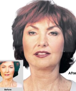 Bring It Up Instant Face Lift Tape Kit: 30-Day Supply, Transparent Neck & Eyebrow Lift Strips, Anti-Wrinkle Stickers 13 617Dwj0UfL