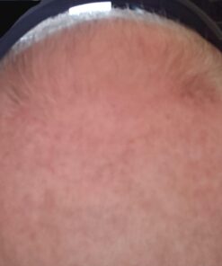 Growth Treatment Unscented 5% (Foam) 2 Ounce (Pack of 1) 17 617KtSSCtL