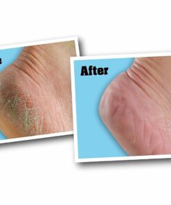 O'Keeffe's for Healthy Feet Foot Cream, Guaranteed Relief for Extremely Dry, Cracked Feet, Instantly Boosts Moisture Levels, 3.2 Ounce Jar, (Pack of 1) 3.2 Ounce (Pack of 1) 36 618EX3kJ01L