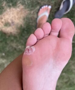 Compound W Maximum Strength One Step Plantar Wart Remover Foot Pads, 20 Count 20 Count (Pack of 1) 43 618UazsRUL