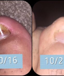 3 in 1 Professional Foot Spa Kit-with Tea Tree Foot & Body Soak-Tea Tree Body Wash & Nail Blend-Soothes Dry, Burning & Itchy Skin-Refreshes Unwanted Foot Odor-Restores Unhealthy Nails-Purely Northwest Tea Tree Oil 3 Piece Set 40 618UygkCKUL