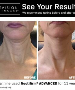 Revision Skincare Nectifirm, target the visible signs of early to moderate aging on the neck and décolletage, helps the neck and jawline firmer and lifted, improves fine lines and wrinkles 1.7 Ounce (Pack of 1) 12 618ZUAgMfmS