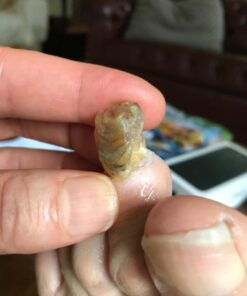 PURELY NORTHWEST-Tea Tree Oil & Peppermint Foot Soak with Epsom Salt-for Stubborn Foot Odor, Athletes Foot Burning & Itching, Damaged Discolored Nails-A Natural Callus Remover 16 Ounces 1 Pound (Pack of 1) 42 6197mCKiETL