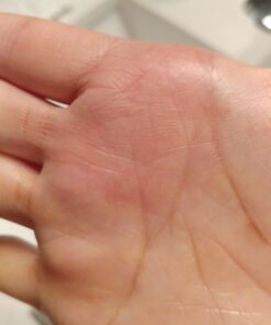 Moisturising Cream, Body and Face Moisturizer for Dry Skin, Acne Cream, 2PC 0.53 Ounce (Pack of 1) 46 619D KyCupL