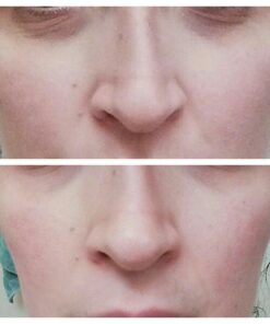 Body Merry Age Defense Eye Cream – Anti-Aging Treatment for Puffy Eyes, Dark Circles, Bags, Fine Lines and Wrinkles – Brightening Daily Face Moisturizer, 1.7 oz 40 619nrnC6hcL