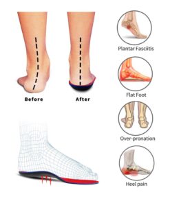 PCSsole Orthotic Arch Support Shoe Inserts Insoles for Flat Feet,Feet Pain,Plantar Fasciitis,Insoles for Men and Women Red Mens 10-10 1/2 | Womens 12-12 1/2 (11.42 Inch) 12 61A2QpGv8zL