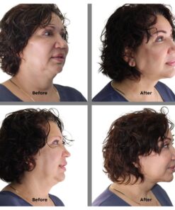 Bring It Up Instant Face Lift Tape Kit: 30-Day Supply, Transparent Neck & Eyebrow Lift Strips, Anti-Wrinkle Stickers 14 61A5NIFAuaL