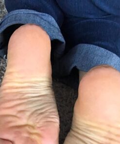 Amope Pedi Perfect Electronic Foot File, Dual-Speed Callus Remover (with Diamond Crystals) for Feet (Extra Coarse - Pink Gadget). -Perfect for In-home Pedicure for Baby Smooth Feet. Battery Operated 42 61ASyaHntJL