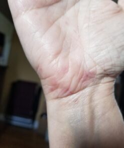 Teliaoils Lemon Balm Salve, Fast Acting/Natural Salve. Cold Sores - Skin Rashes - Irritated Skin - Itchy Skin. (1.7 Oz / 50 Ml) 1.76 Ounce (Pack of 1) 30 61Awk2hm81L