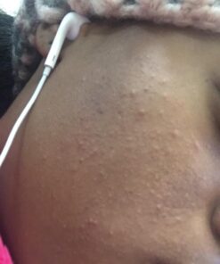 Viva Naturals Jojoba Oil Organic Cold Pressed Unrefined - 100% Pure Jojoba Oil for Skin, Natural Face Moisturizer and Hair Moisturizer, USDA Certified Organic Face Oil for Skin Care DIY, 4 fl. oz 4 Fl Oz (Pack of 1) 58 61AxxPlYBtL