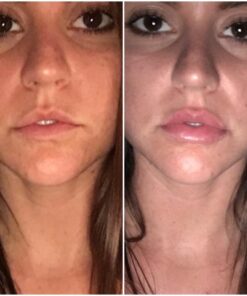 Fullips Lip Plumper Tool - Medium Oval with Bonus Large Round Enlarger - Self Suction Plumping Device For Fuller Lips - Plump in Seconds - Natural Instant Lip Enhancement Kit - Red Plastic Plumpers 59 61BVadISFNL