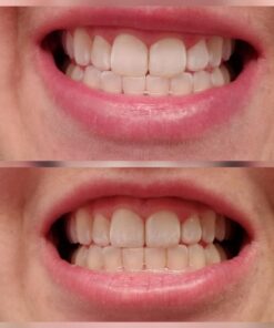 Active Wow Activated Coconut Charcoal Powder - Natural Whitening Activated Charcoal, Charcoal Vanilla Toothpaste, Fluoride Free, Sulfate & Paraben Free, Charcoal Toothpaste Powder (All Natural) All Natural 60 61Bnz5PxPDL