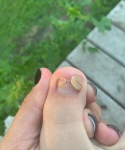 PURELY NORTHWEST-Tea Tree Oil & Peppermint Foot Soak with Epsom Salt-for Stubborn Foot Odor, Athletes Foot Burning & Itching, Damaged Discolored Nails-A Natural Callus Remover 16 Ounces 1 Pound (Pack of 1) 34 61BrIiTSq4L