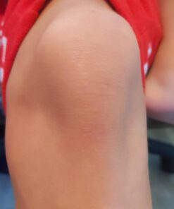 Compound W One Step Wart Remover Strips for Kids, 10 Medicated Strips for Wart Removal, 2 Pack unflavored 10 Count (Pack of 2) 49 61CAWa CSrL