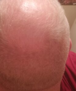 Growth Treatment Unscented 5% (Foam) 2 Ounce (Pack of 1) 18 61CKjr8qLAL