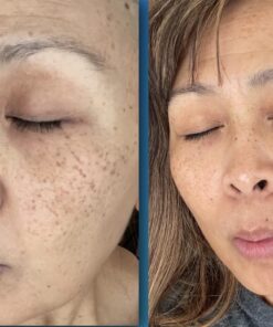 TruSkin Vitamin C Face Serum – Anti Aging Face & Eye Serum with Vitamin C, Hyaluronic Acid, Vitamin E – Brightening Serum, Dark Spot Remover, Even Skin Tone, Eye Area, Fine Lines & Wrinkles, 1 Fl Oz 1 Fl Oz (Pack of 1) 37 61CQUiVYFCL