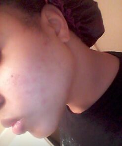 Mario Badescu Glycolic Foaming Cleanser for All Skin Types Glycolic Foaming Cleanser 6 Fl Oz 35 61CXHs6WuCL