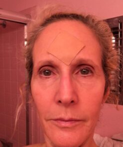 Frownies (FBE) Forehead & Between Eyes, 144 Patches (3) pack 5 61ChpgwTBCL