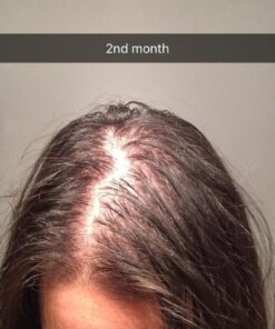 Newopure: Natural Hair Growth Vitamins, Repairs Hair Follicles, Stops Hair Loss, Blocks DHT, Stimulates New Hair Growth, Promotes Thicker, Fuller and Faster Growing Hair. Men & Women (30 Day Supply) 20 61CkTMtPhL