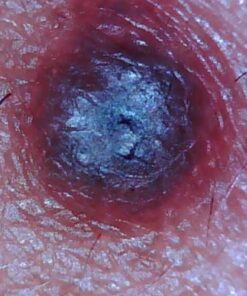 Dino Lite USB Hanheld Digital Microscope, 10x-220x Magnification 0.3MP/1.3MP/5.0MP True Resolution, Windows/Mac/iOS/Android Software Included, Supports PC, Tablet, Mobile Devices 39 61Cx0BJWFJL