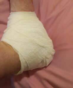 Surgical Gauze Bandage Rolls (4 inch) - Pack of 24 with Bonus Tape - Essential for First Aid and Medical Supplies - Medical Supplies for Wound Care - Breathable Medical Tape 4 Inch 24 Pack 37 61D6eP7qL