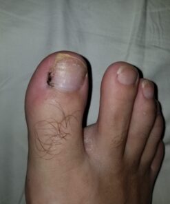 AMERIGEL Hydrogel Wound Dressing (1 oz.) Two Pack - Provides Moisture-Rich Healing Environment for Dry Wounds 1 Ounce (Pack of 2) 19 61DZIx9ibkL