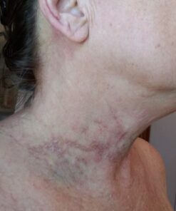 Tea Tree Oil Balm , Extra Strength, Pair Well with Jock Itch Cream, Spray, Athletes Foot, Ringworm Cream for Human, Fast Acting for Dry, Itchy Skin, Plant Powered Wonder Balm 31 61DcPQoscEL